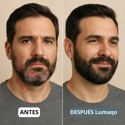 DermaCalma™ Pro+ | Barba y Cuero Cabelludo Calmados