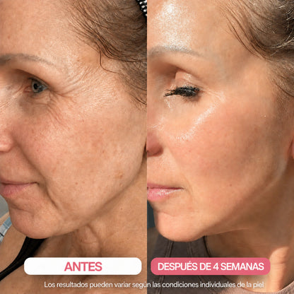 ZELTOA® Tratamiento Nocturno Intensivo | Firmeza y Luminosidad