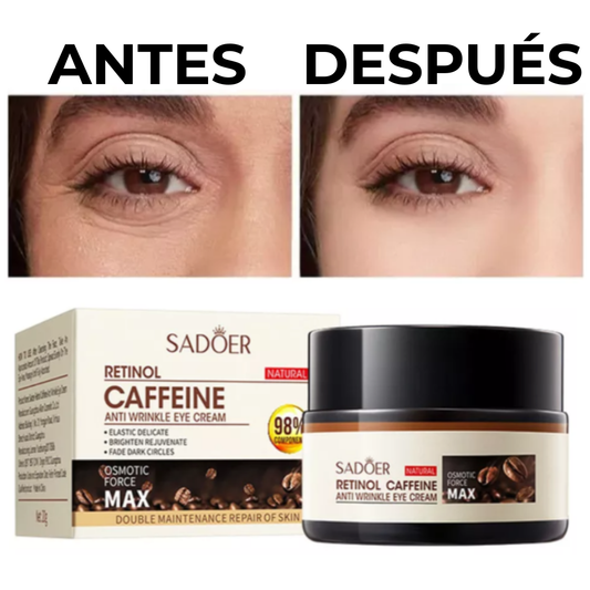 Crema Contorno de Ojos Retinol™ | Antiojeras & Rejuvenecedora (20 g)