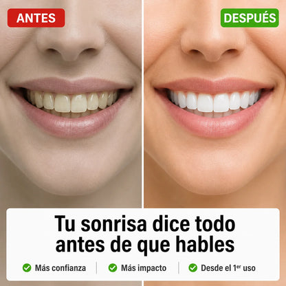 Pasta Dental Morada Whitesmile | Sonrisa Más Blanca Desde el Primer Uso