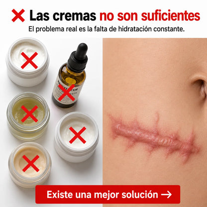 Cinta de Silicona Médica | Borra Cicatrices Sin Láser Ni Cirugías