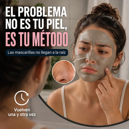 Extractor de Puntos Negros | Piel Limpia Sin Dolor Desde el Primer Uso