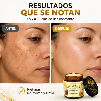 Crema Veneno de Abeja | Adiós Manchas y Cicatrices en 7 Días