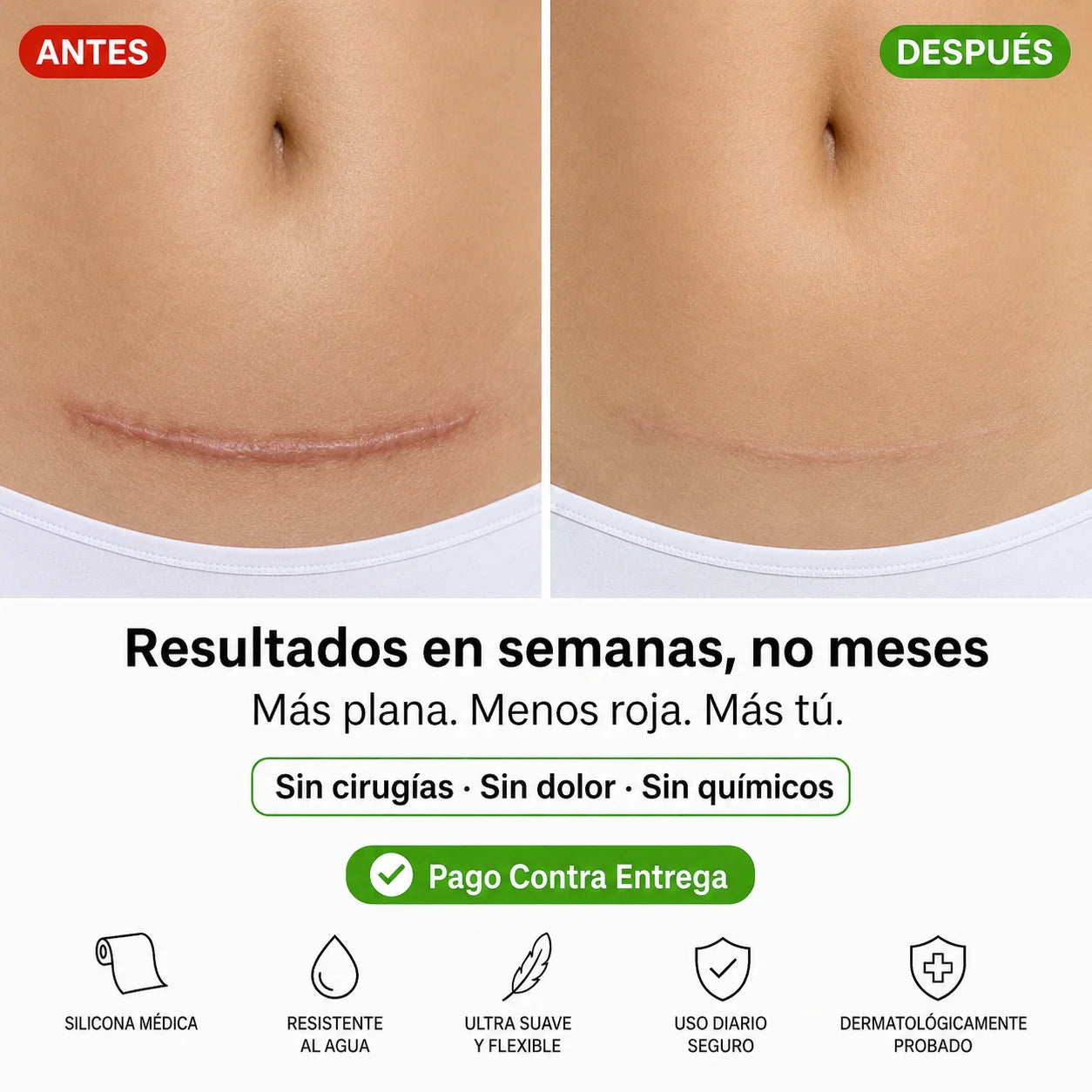 Cinta de Silicona Médica | Borra Cicatrices Sin Láser Ni Cirugías