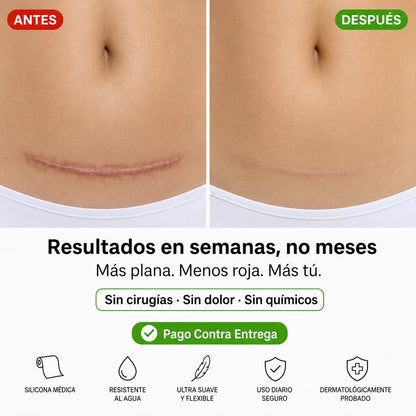 Cinta de Silicona Médica | Borra Cicatrices Sin Láser Ni Cirugías