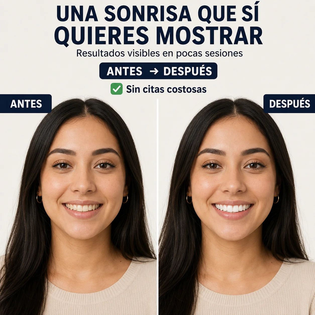 Acelerador Dental LED | Sonrisa Blanca en Minutos