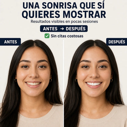 Acelerador Dental LED | Sonrisa Blanca en Minutos