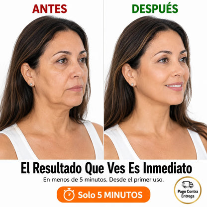 Bandas Lifting Facial Invisible | Luce 10 Años Más Joven en 5 Minutos