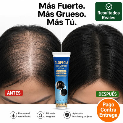 Crema Crecimiento Capilar | Recupera Tu Cabello Sin Medicamentos