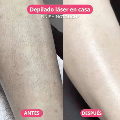 FinishingTouch™ | Depiladora Láser Corporal