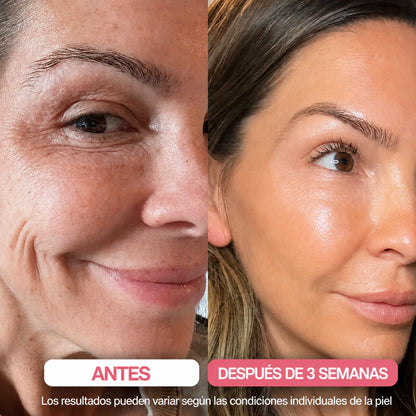 ZELTOA® Tratamiento Nocturno Intensivo | Firmeza y Luminosidad